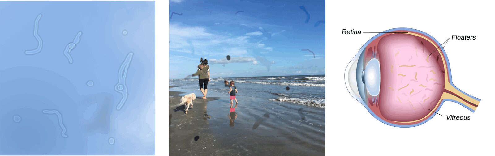 photo - floaters